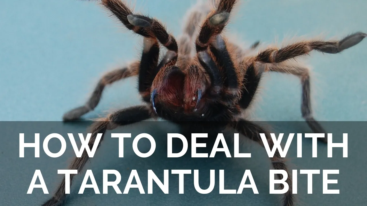 19537 tarantula dry bite first aid